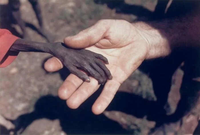 A Starving Boy And A Missionary In Uganda, 1980