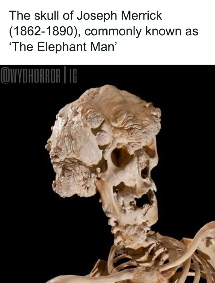 50 Creepy Real-World Facts And Pics That Are More Disturbing Than Most Horror Movies