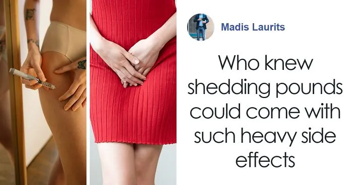 People Have Hilarious Reactions To Latest Weight Loss Meds Side Effect, The "Ozempic Vulva"