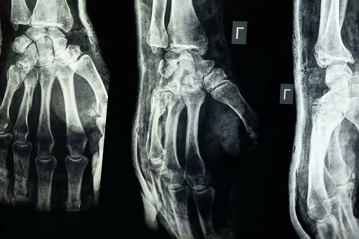 29 Smallest Human Mistakes That Led To Massive Changes In World History