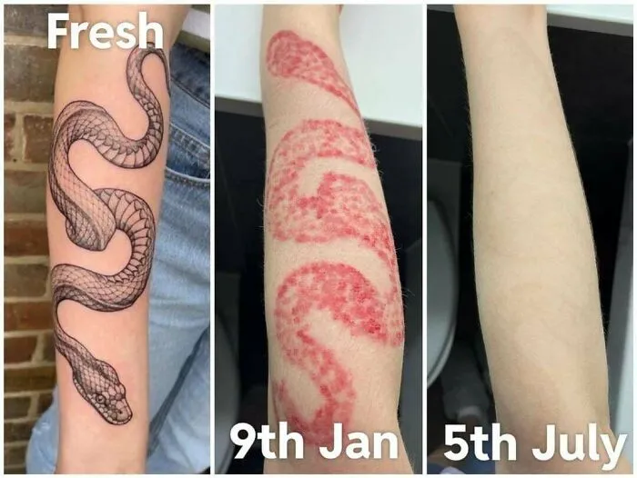Before and after photos showing a fading snake tattoo over several months illustrating tattoo mistake corrections.