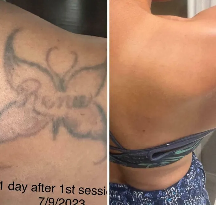 Finally Done After 2 Years & 8 Sessions