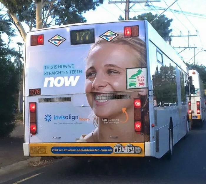Bus advertisement fail showing a smiling woman with braces aligned awkwardly with the bus's rear lights and features.