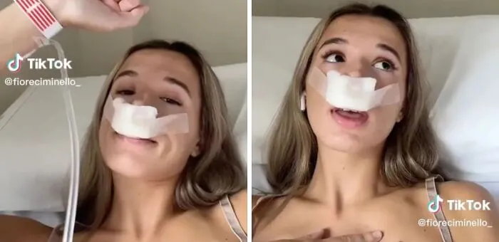Tiktoker Claims She Got Plastic Surgery So Her Kids Would Inherit Her New Nose… And Everyone’s Saying The Same Thing