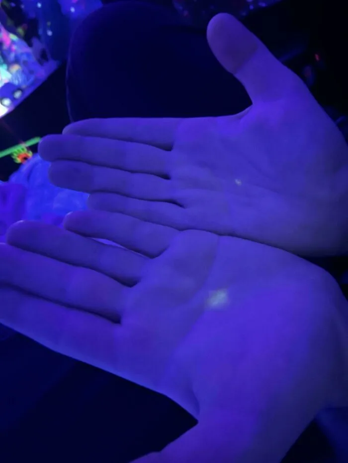 ¿Puntos extraños en las manos de mi novio que solo aparecen con luz ultravioleta?