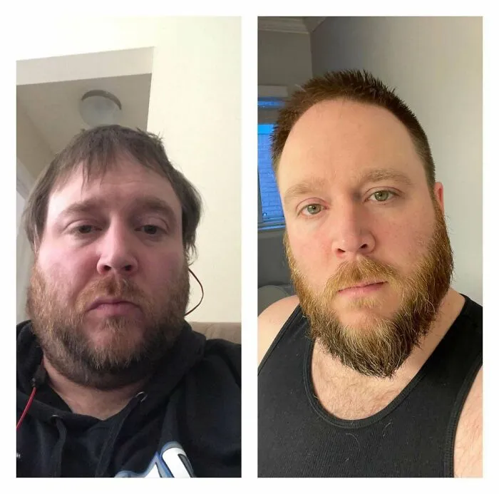 1 Year Sober From Alcohol. I Never Thought I’d Be Able To Post This. But Here It Is! Life Isn’t Perfect, But Holy S**t Is It So Much Better!