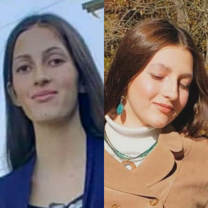 Anorexia Recovery Face Gains!