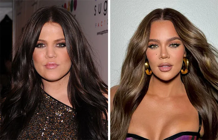 Khloe Kardashian
