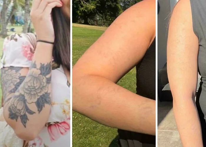 Antes y después