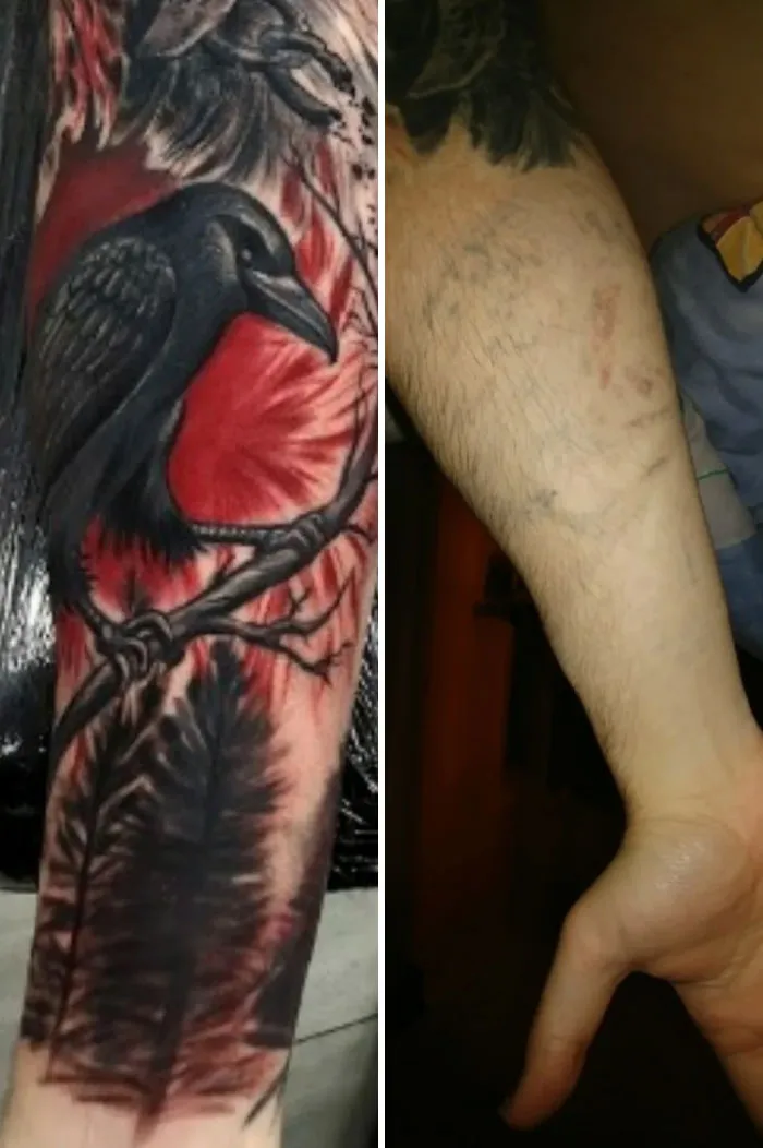 Before and after photos showing tattoo mistakes removed from a forearm with detailed black and red crow tattoo.