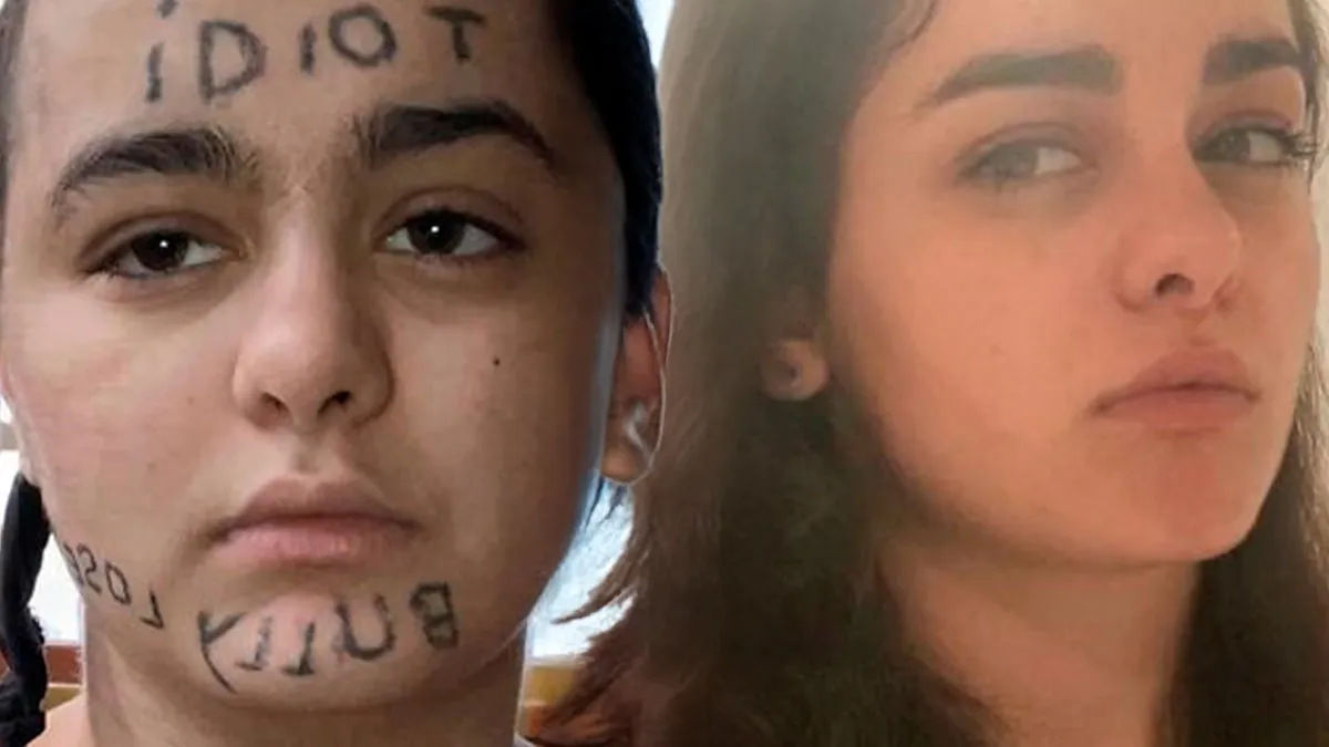 “Changed My Life!” 50 Photos Before And After Tattoo Removal
