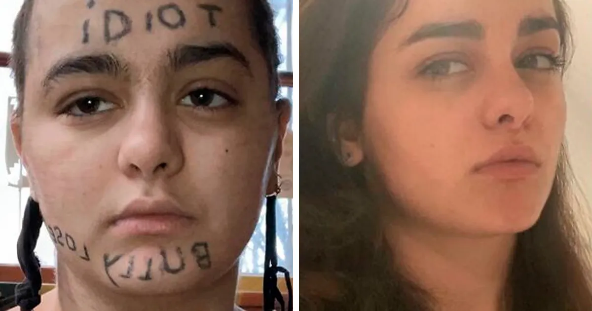 27 Fotos del antes y después de borrarse un tatuaje