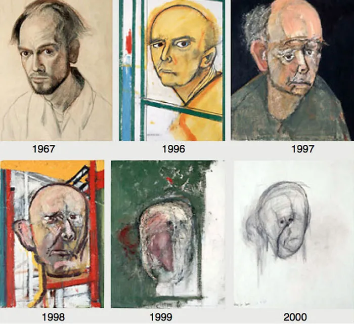 Los autorretratos revelan el deterioro del artista a causa de la enfermedad de Alzheimer.