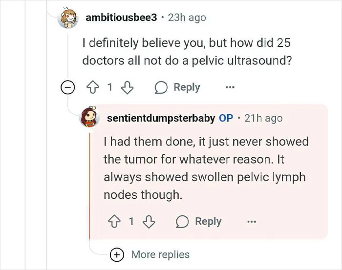 Reddit conversation about a woman who thought she was pregnant but gave birth to a tumor instead, discussing pelvic ultrasound.