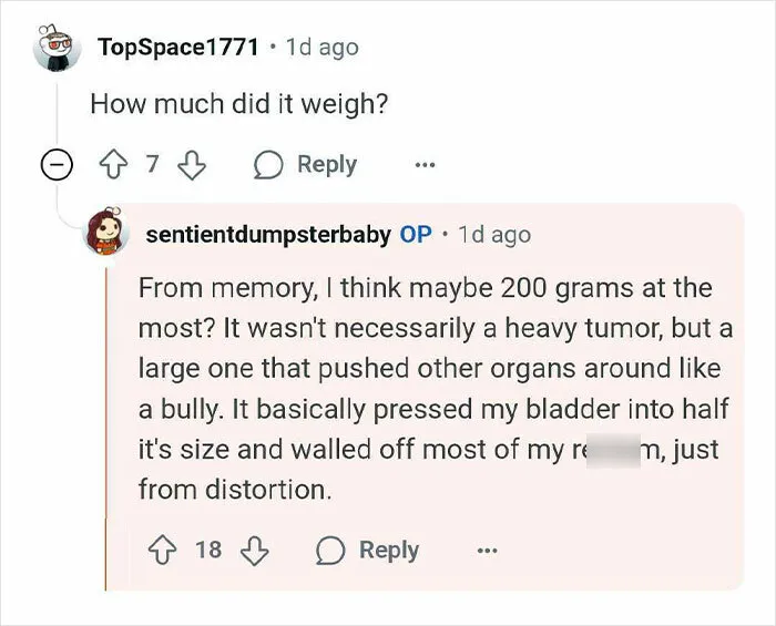 Reddit comment exchange discussing the weight and impact of a tumor mistaken for pregnancy symptoms.