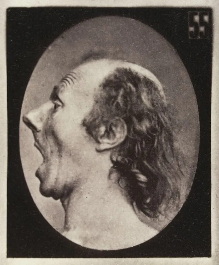 Astonishment