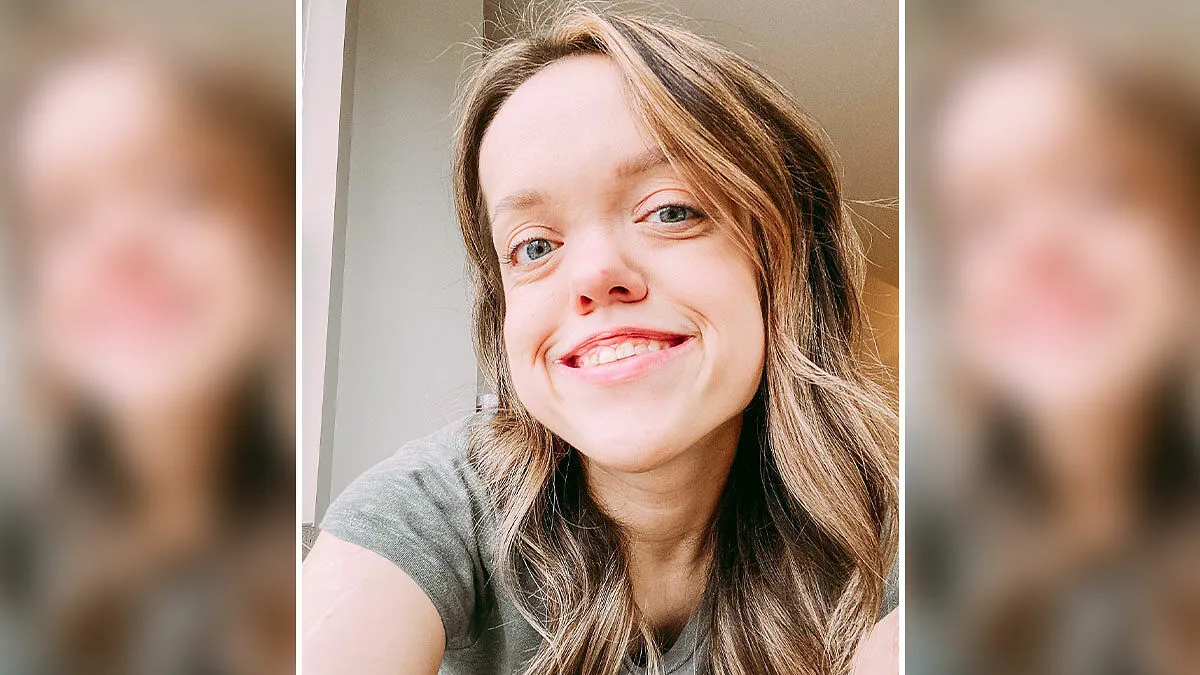 31YO Woman With Dwarfism Who Had Height Surgery As A Teen Stuns Fans With Transformation