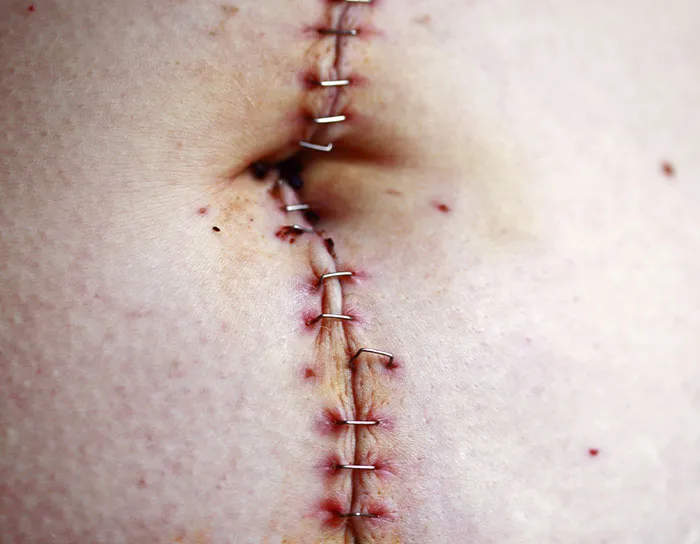 ER Nurses Share Wild “One More Minute And I’d Be Dead” Stories From The Hospital
