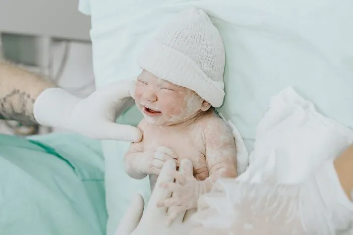 42 Rare Diseases That Sound Like A Science Fiction Plot But Are 100% Real