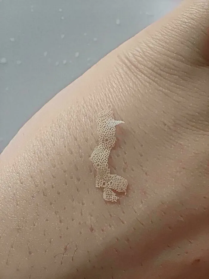 Some Skin Peeled Off My Tongue