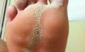 Trypophobia Warning: 50 Unsettling Pics You Won’t Be Able To Unsee (New Pics)