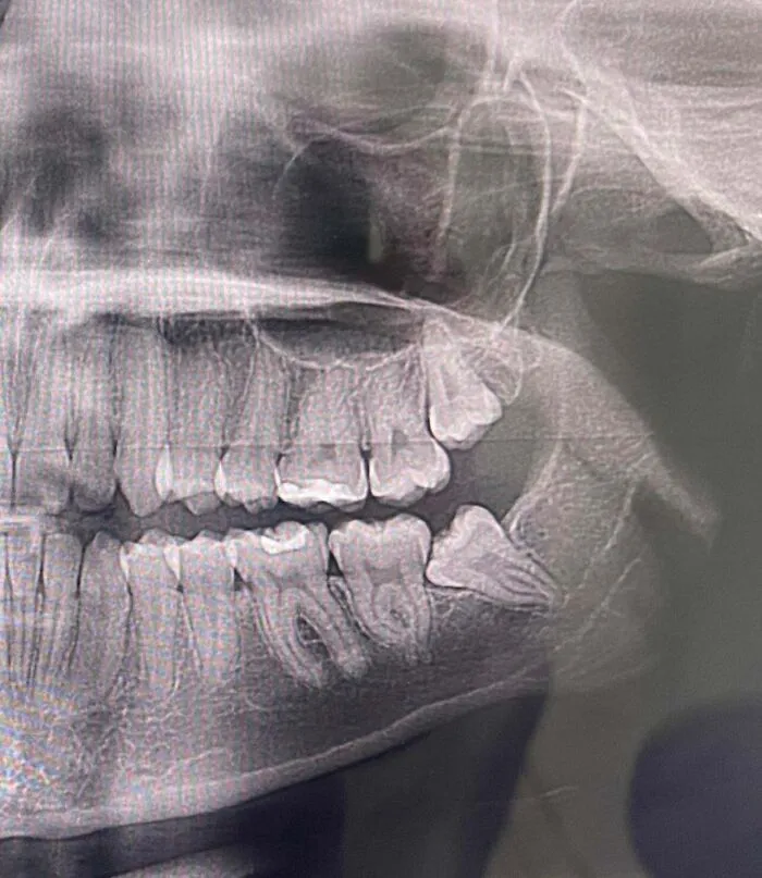 Dentist Office Charged My Sister $500 For A CT Scan They Never Performed