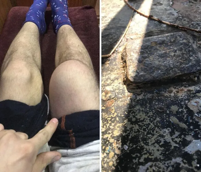 Me golpeé la rodilla con toda mi fuerza contra este borde metálico.