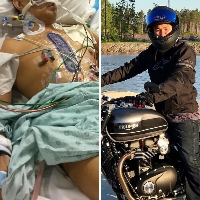 ¡Hoy hace un año que recibí un nuevo corazón! Eternamente agradecido a mi donante y a su familia. A mi equipo de trasplante de corazón, médicos y enfermeras: ¡Son increíbles!