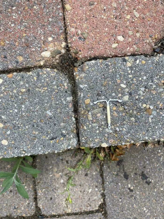 Encontré un DIU en el suelo en mi camino al dentista