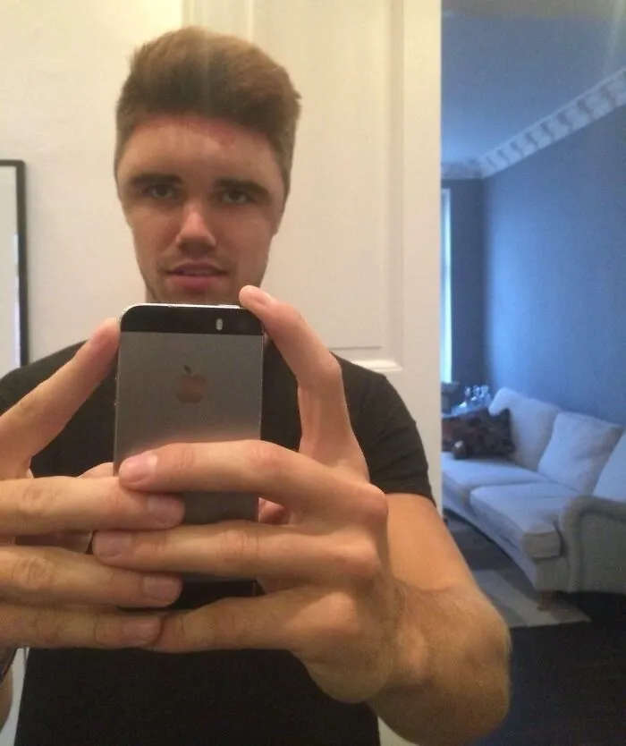Mi amigo es aparentemente alérgico al tinte para el cabello