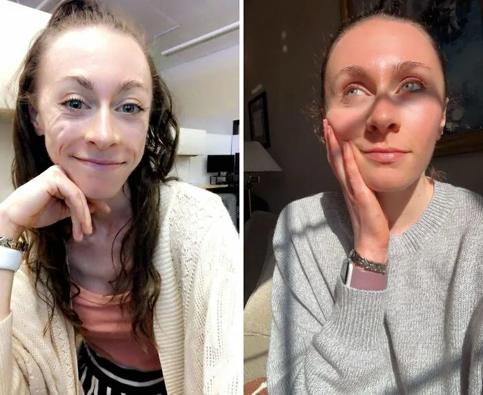 Around A Year Between These Photos