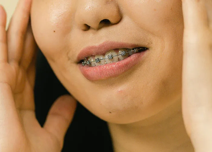 “It Looked Better Just Thick And Fat”: 45 Beauty Procedures People Regret Having Done