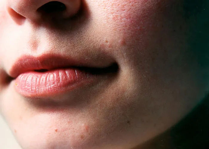 “It Looked Better Just Thick And Fat”: 45 Beauty Procedures People Regret Having Done