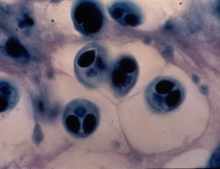 Myxobolus Shekel