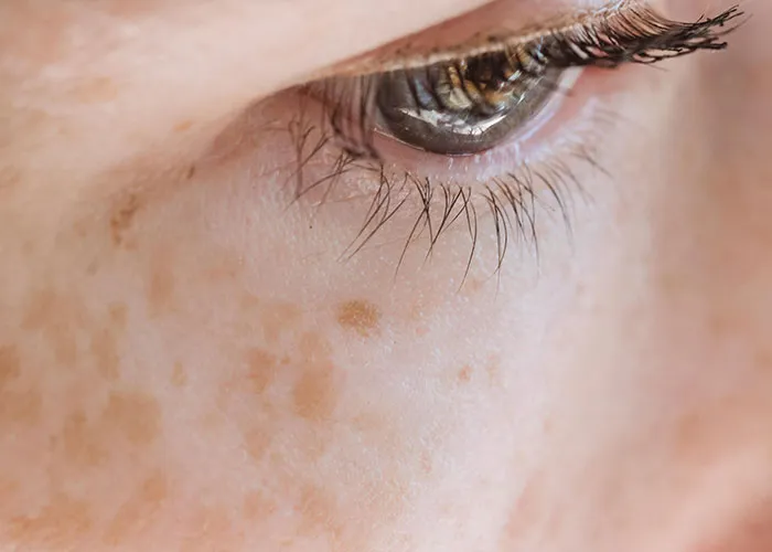“It Looked Better Just Thick And Fat”: 45 Beauty Procedures People Regret Having Done