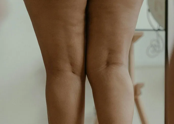 “It Looked Better Just Thick And Fat”: 45 Beauty Procedures People Regret Having Done