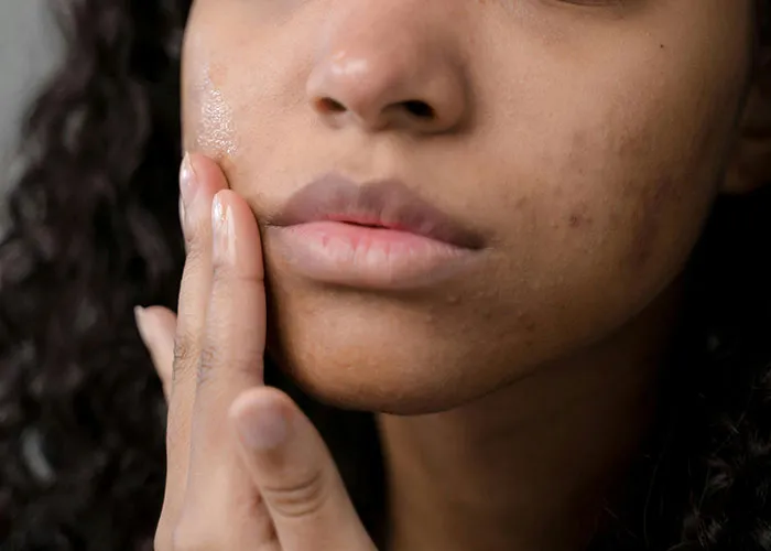 “It Looked Better Just Thick And Fat”: 45 Beauty Procedures People Regret Having Done