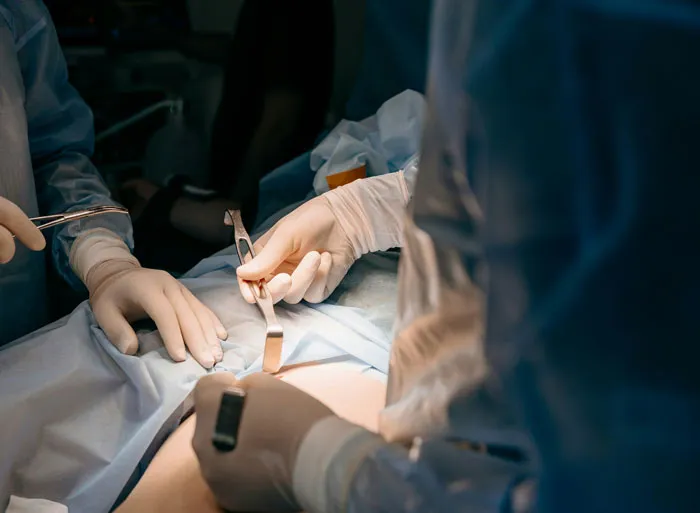 “Plastic Surgeons, What’s The Most Ridiculous Surgery You’ve Performed?”