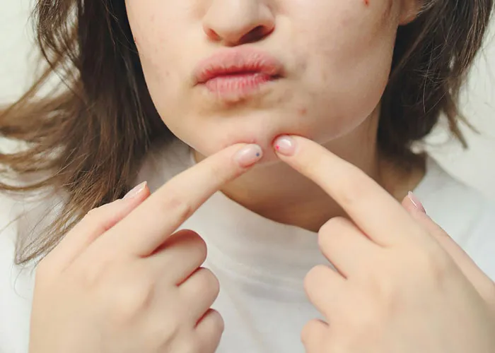 “It Looked Better Just Thick And Fat”: 45 Beauty Procedures People Regret Having Done