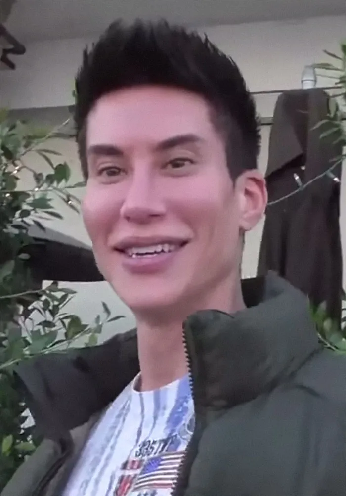 “Plastic Surgeons, What’s The Most Ridiculous Surgery You’ve Performed?”