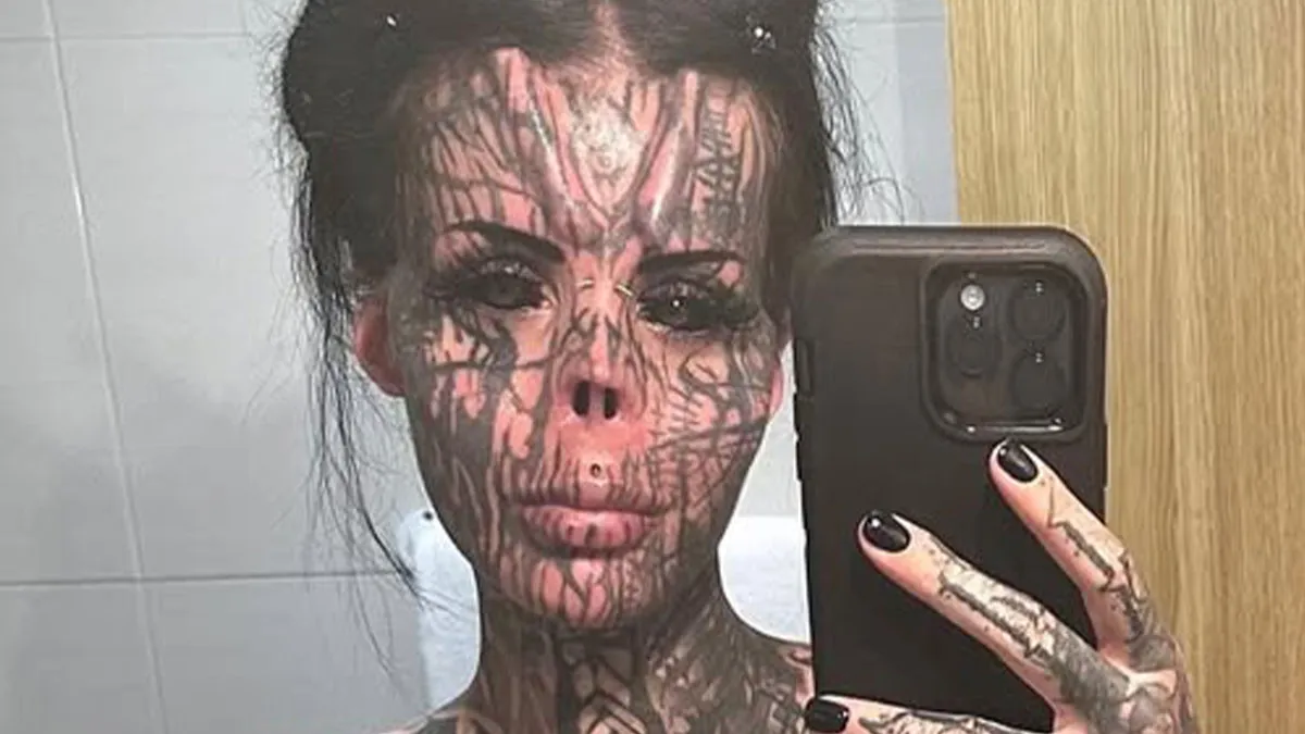 Woman Who Cut Her Nose Off Shares Shocking Before-And-After Pics