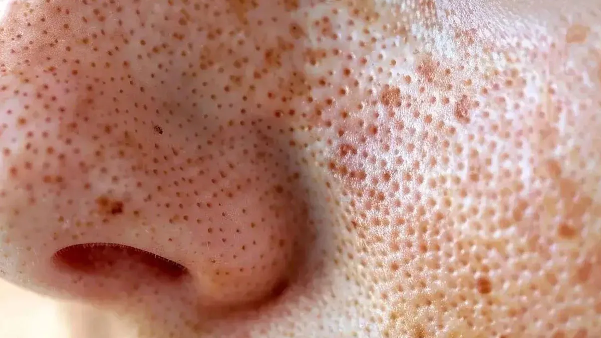 Trypophobia Warning: 50 Unsettling Pics You Won’t Be Able To Unsee (New Pics)