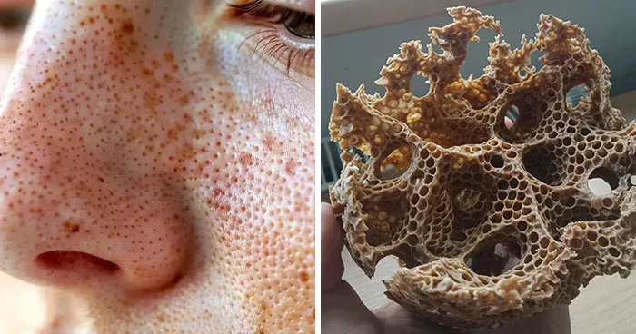 Trypophobia Warning: 50 Unsettling Pics You Won’t Be Able To Unsee (New Pics)