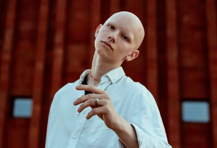A confident young person wearing a white shirt posing outdoors symbolizing popular kids turned into outcasts in school.