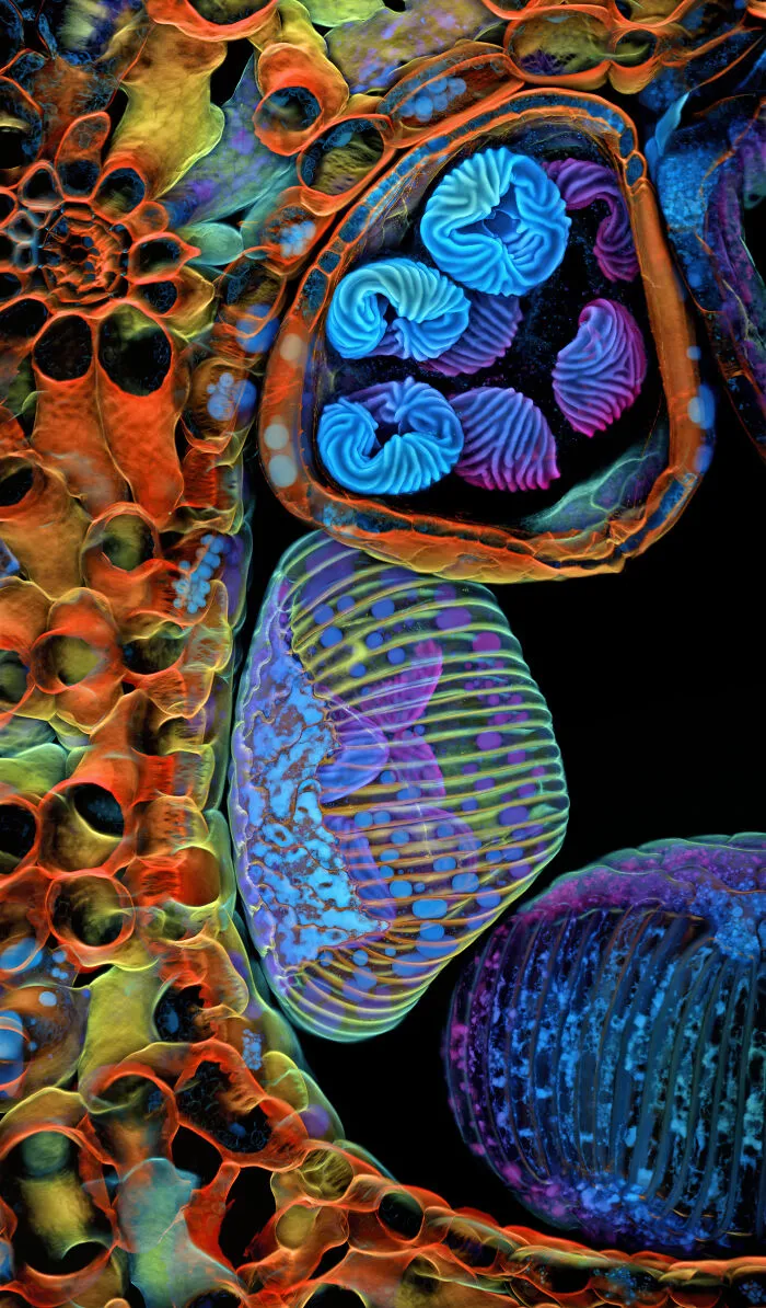 5th Place: Dr. Igor Siwanowicz, Howard Hughes Medical Institute (Hhmi), Janelia Research Campus, Ashburn, Virginia, USA