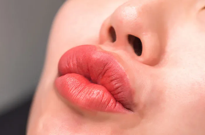22 Times Plastic Surgery Went Horribly Wrong, And How People Handled It