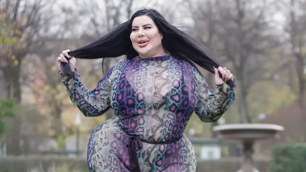 Plastic Surgery Enthusiast Who Paid $148k For 5 BBLs Shocks The Internet With Her 'Before' Photos