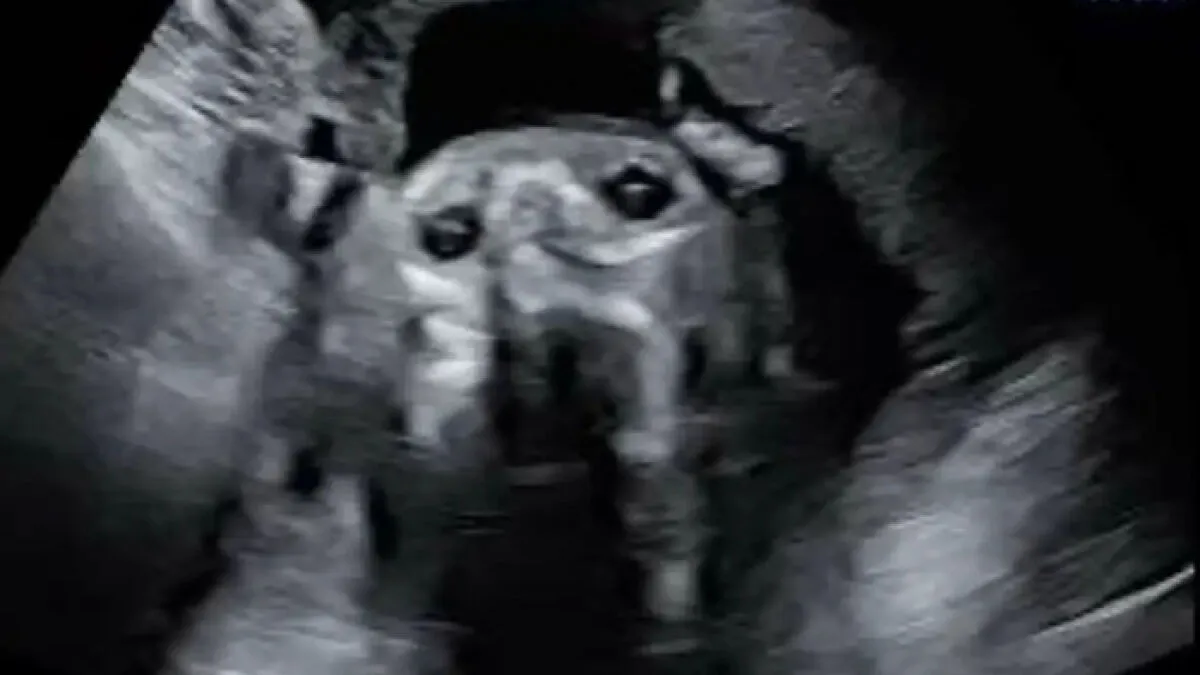 Pregnant Woman's Sonogram Image Goes Viral After She Spots Hilarious Detail