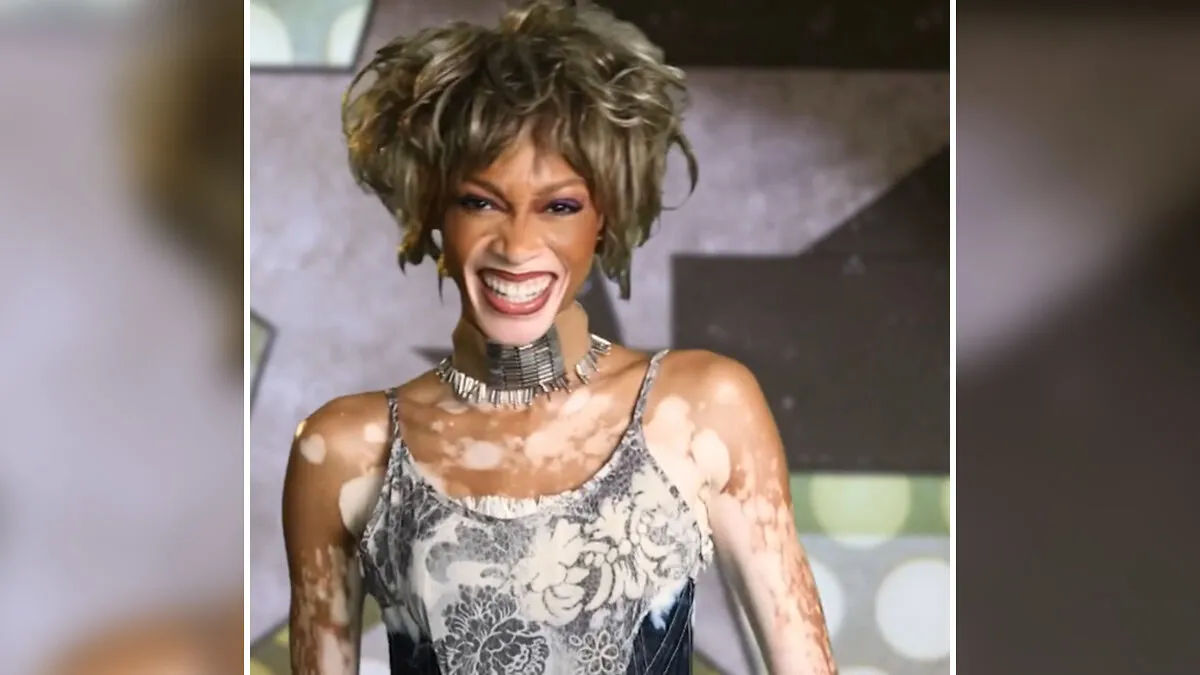"Very Disrespectful To Me": Winnie Harlow Faces Backlash After Channeling Whitney Houston For Halloween