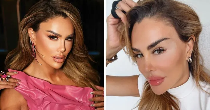 "Risking Blindness": Actress Reveals She Had Controversial Surgery To Change Her Eye Color